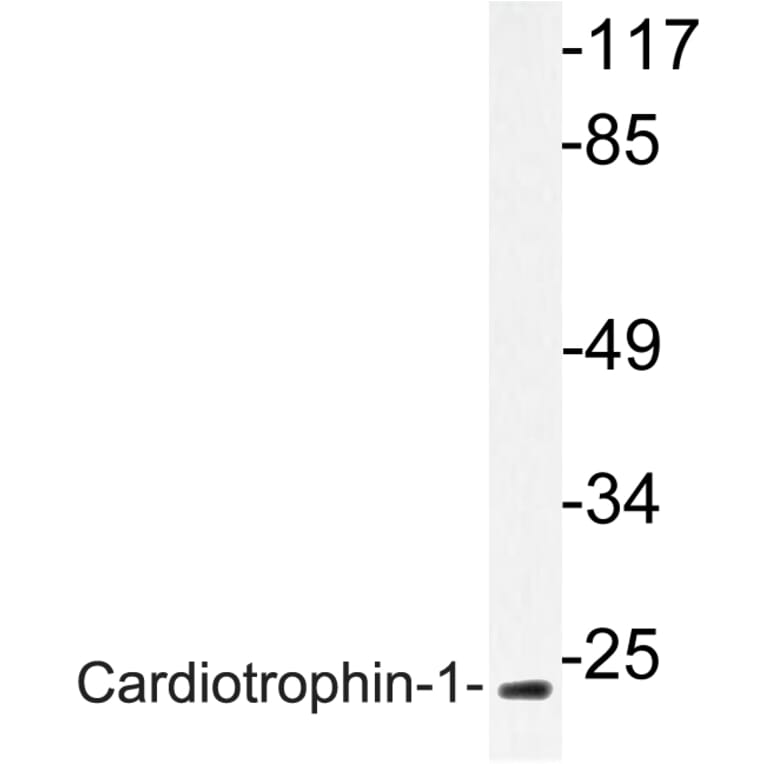 Western Blot - Anti-Cardiotrophin-1 Antibody (R12-2052) - Antibodies.com