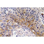 Immunohistochemistry - Anti-Cardiotrophin-1 Antibody (R12-2052) - Antibodies.com