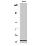 Western Blot - Anti-Cardiotrophin-1 Antibody (R12-2052) - Antibodies.com
