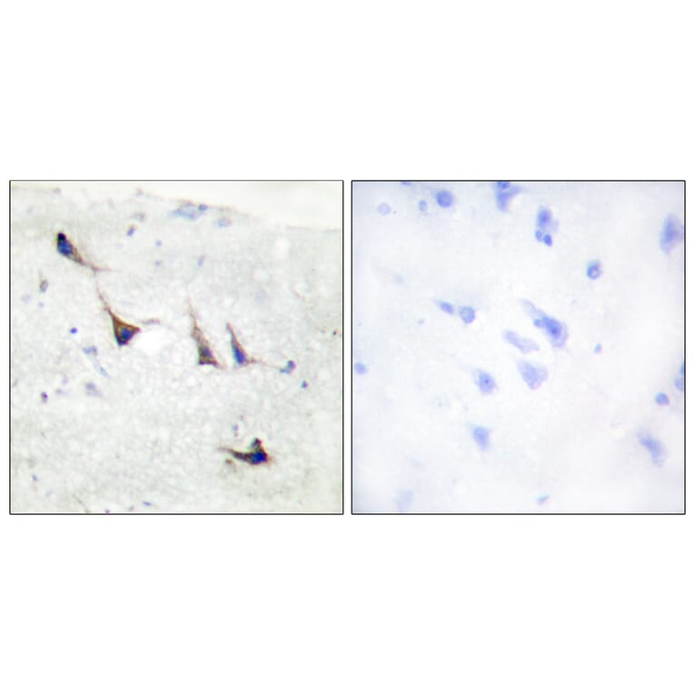 Immunohistochemistry - Anti-Syntaxin 1A Antibody (B1238) - Antibodies.com