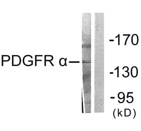Western Blot - Anti-PDGFR alpha Antibody (C0300) - Antibodies.com