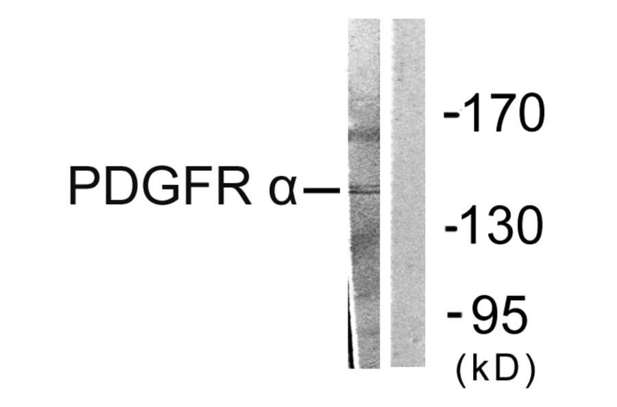 Western Blot - Anti-PDGFR alpha Antibody (C0300) - Antibodies.com