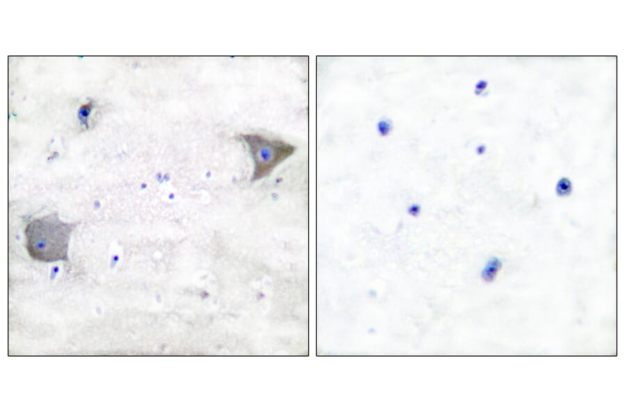 Immunohistochemistry - Anti-PDGFR alpha Antibody (C0300) - Antibodies.com