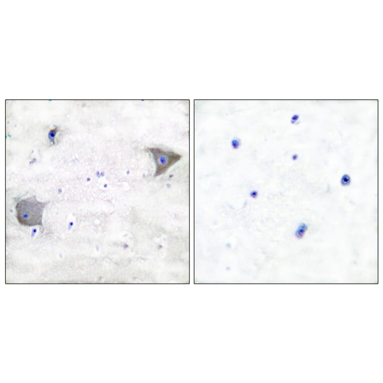 Immunohistochemistry - Anti-PDGFR alpha Antibody (C0300) - Antibodies.com