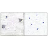 Immunohistochemistry - Anti-PDGFR alpha Antibody (C0300) - Antibodies.com