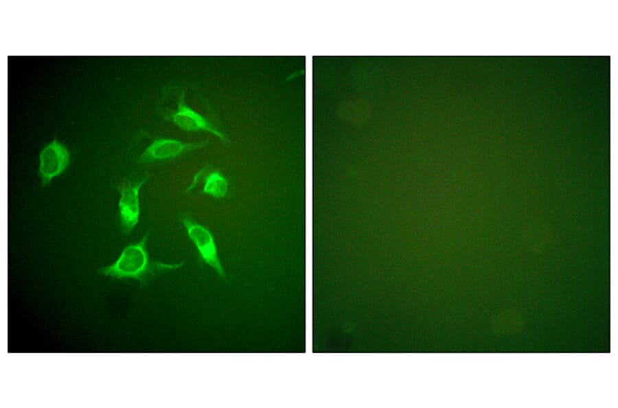 Immunofluorescence - Anti-PDGFR alpha Antibody (C0300) - Antibodies.com