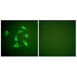 Immunofluorescence - Anti-PDGFR alpha Antibody (C0300) - Antibodies.com