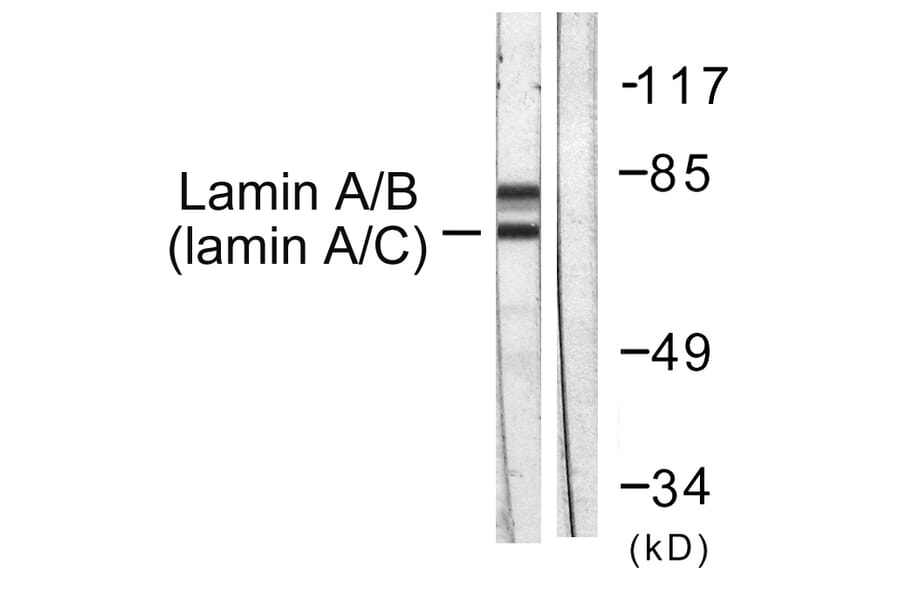 Western Blot - Anti-Lamin A + C Antibody (B0503) - Antibodies.com