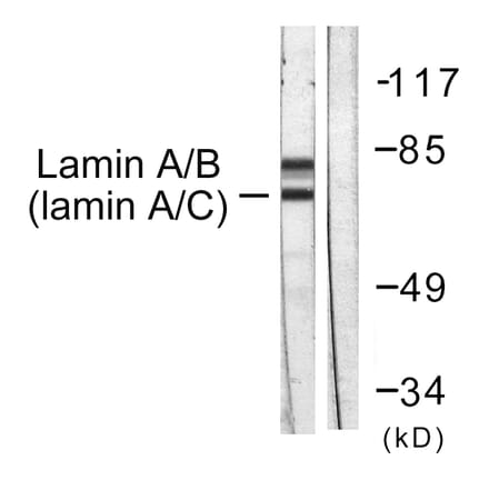 Western Blot - Anti-Lamin A + C Antibody (B0503) - Antibodies.com
