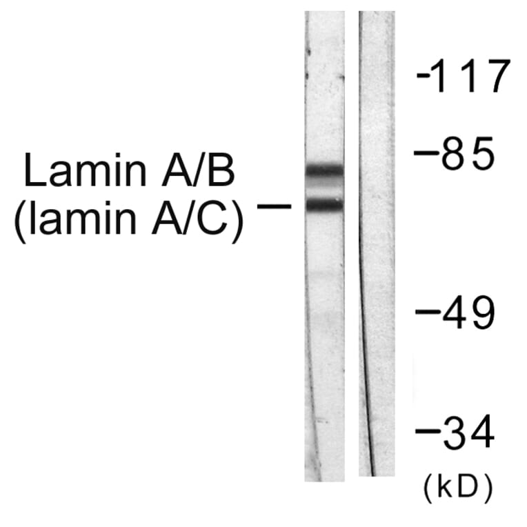 Western Blot - Anti-Lamin A + C Antibody (B0503) - Antibodies.com