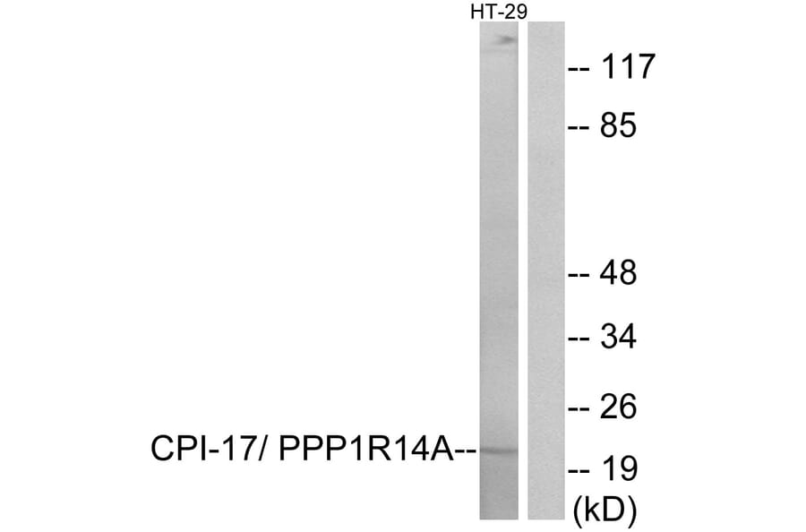 Western Blot - Anti-CPI17 alpha Antibody (B7051) - Antibodies.com
