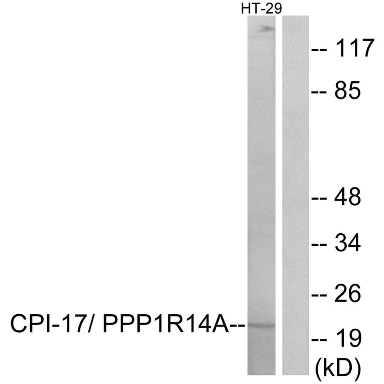 Western Blot - Anti-CPI17 alpha Antibody (B7051) - Antibodies.com