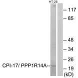 Western Blot - Anti-CPI17 alpha Antibody (B7051) - Antibodies.com