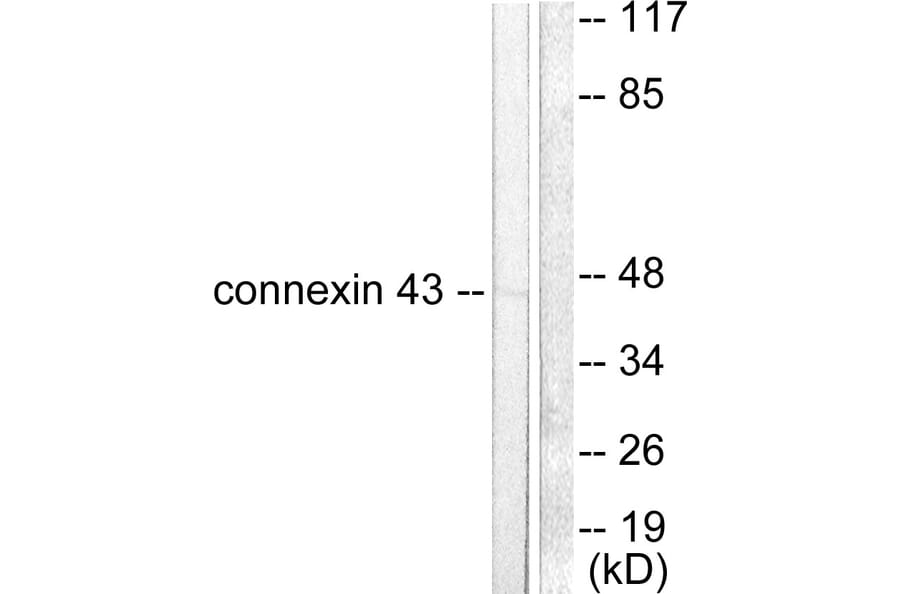 Western Blot - Anti-Connexin 43 Antibody (C0158) - Antibodies.com