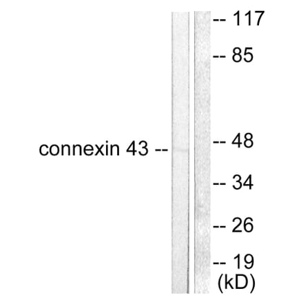 Western Blot - Anti-Connexin 43 Antibody (C0158) - Antibodies.com