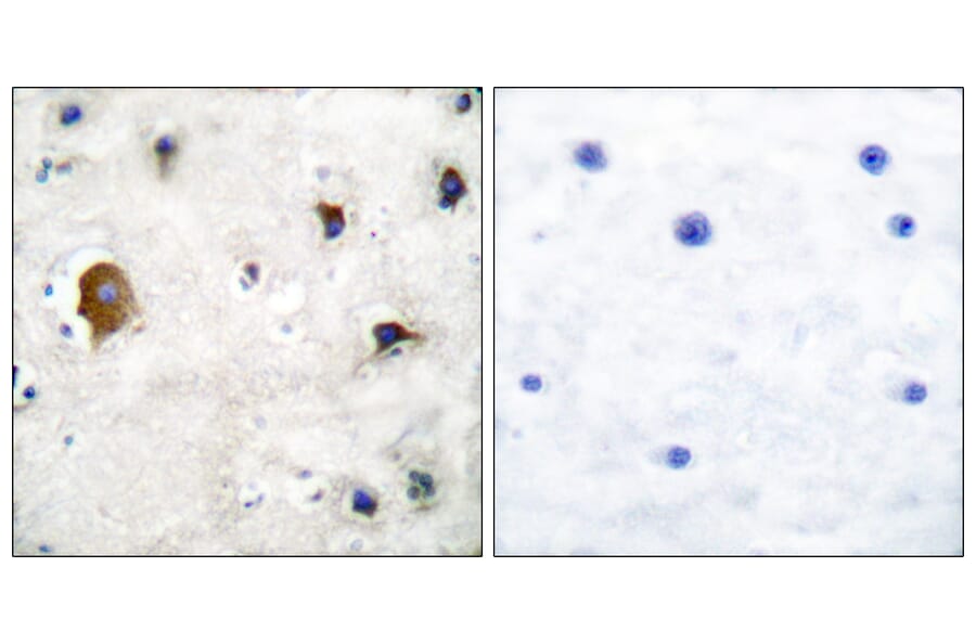 Immunohistochemistry - Anti-Connexin 43 Antibody (C0158) - Antibodies.com