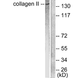 Western Blot - Anti-Collagen II Antibody (C0155) - Antibodies.com