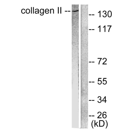 Western Blot - Anti-Collagen II Antibody (C0155) - Antibodies.com