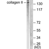 Western Blot - Anti-Collagen II Antibody (C0155) - Antibodies.com