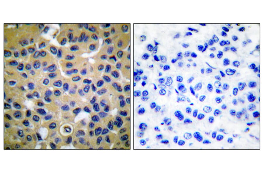 Immunohistochemistry - Anti-Collagen II Antibody (C0155) - Antibodies.com