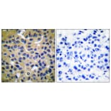 Immunohistochemistry - Anti-Collagen II Antibody (C0155) - Antibodies.com