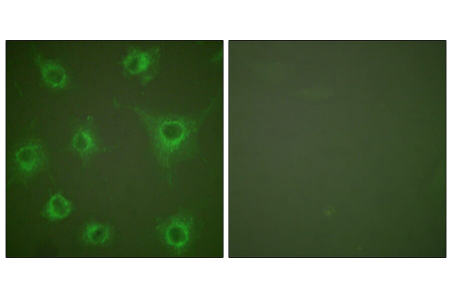 Immunofluorescence - Anti-Collagen II Antibody (C0155) - Antibodies.com