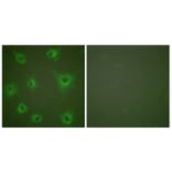 Immunofluorescence - Anti-Collagen II Antibody (C0155) - Antibodies.com