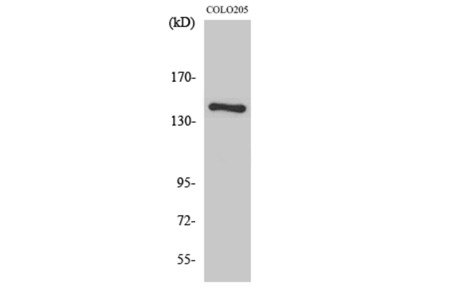 Western Blot - Anti-Collagen II Antibody (C0155) - Antibodies.com