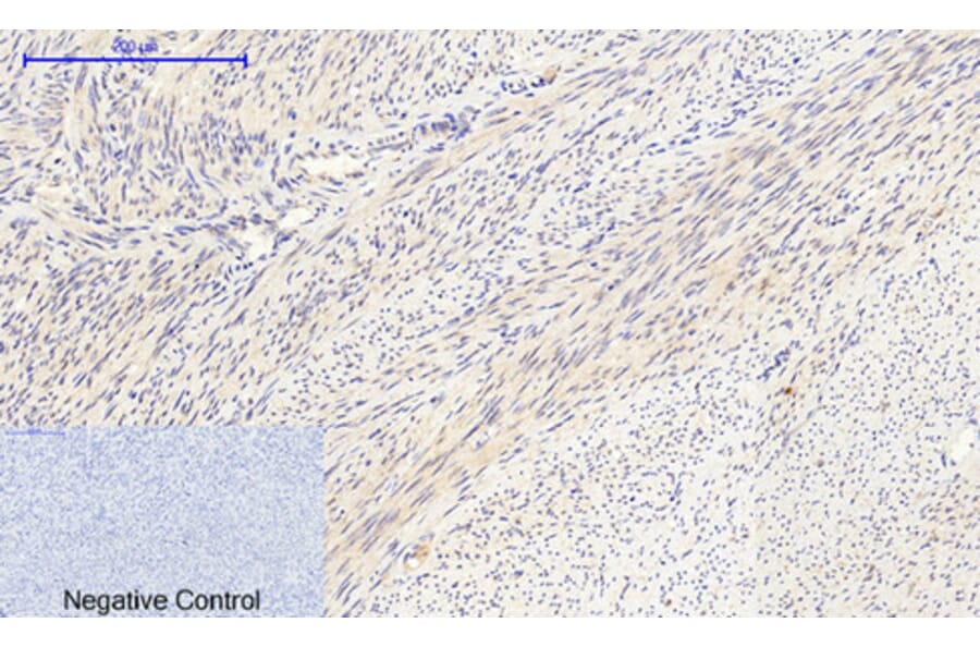 Immunohistochemistry - Anti-Collagen II Antibody (C0155) - Antibodies.com