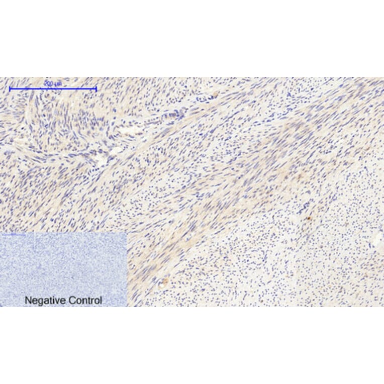 Immunohistochemistry - Anti-Collagen II Antibody (C0155) - Antibodies.com