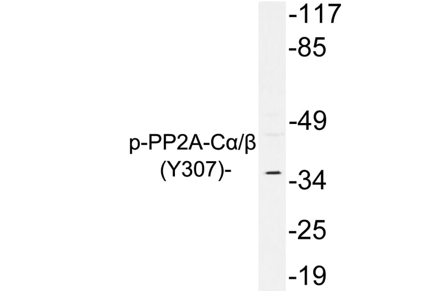 Western Blot - Anti-PP2A C alpha + beta (phospho Tyr307) Antibody (P12-1048) - Antibodies.com