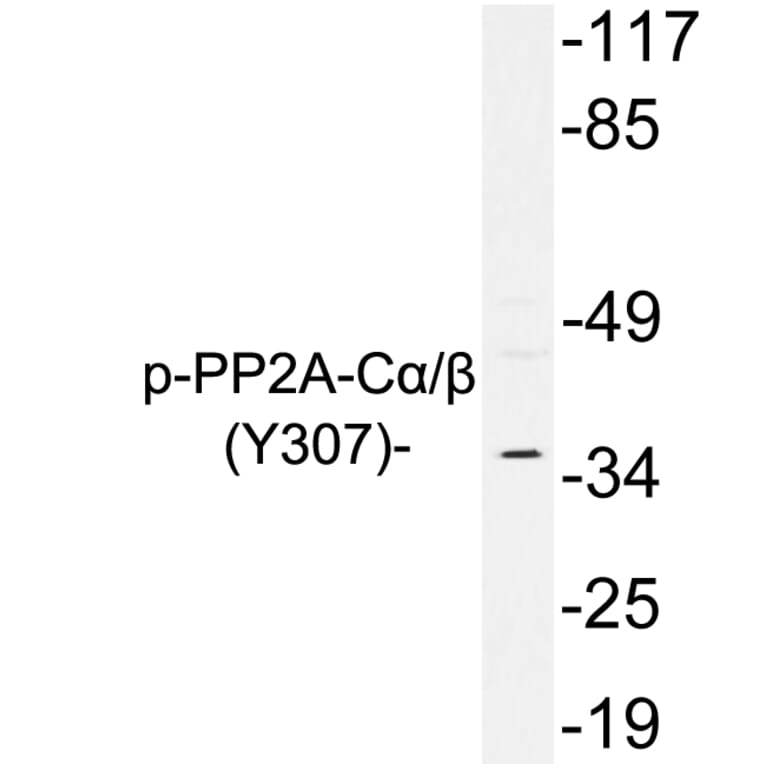 Western Blot - Anti-PP2A C alpha + beta (phospho Tyr307) Antibody (P12-1048) - Antibodies.com