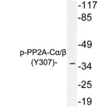 Western Blot - Anti-PP2A C alpha + beta (phospho Tyr307) Antibody (P12-1048) - Antibodies.com