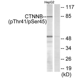 Western Blot - Anti-beta Catenin (phospho Thr41 + Ser45) Antibody (A7024) - Antibodies.com