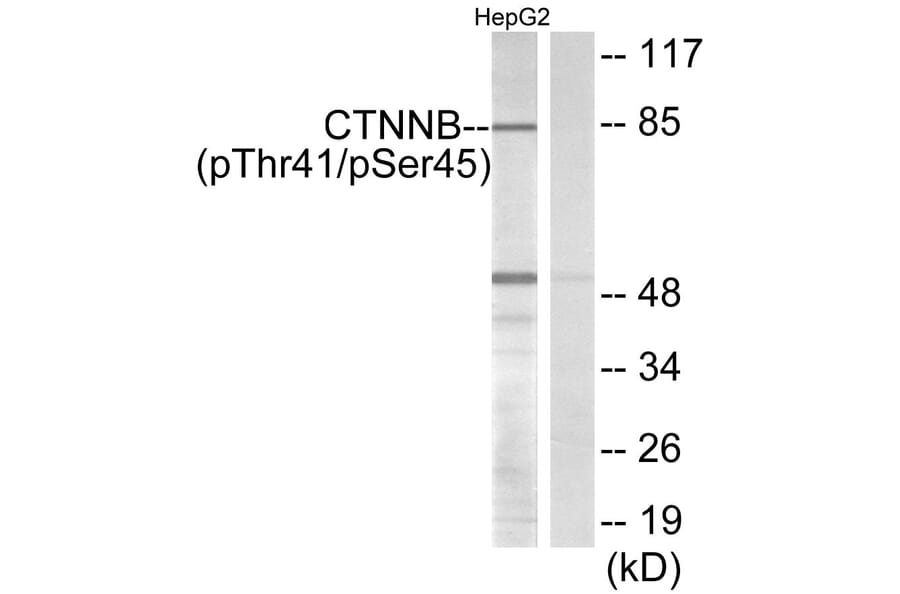 Western Blot - Anti-beta Catenin (phospho Thr41 + Ser45) Antibody (A7024) - Antibodies.com