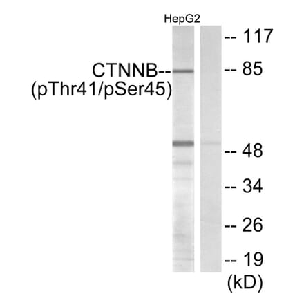 Western Blot - Anti-beta Catenin (phospho Thr41 + Ser45) Antibody (A7024) - Antibodies.com