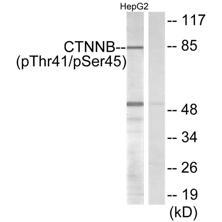 Western Blot - Anti-beta Catenin (phospho Thr41 + Ser45) Antibody (A7024) - Antibodies.com