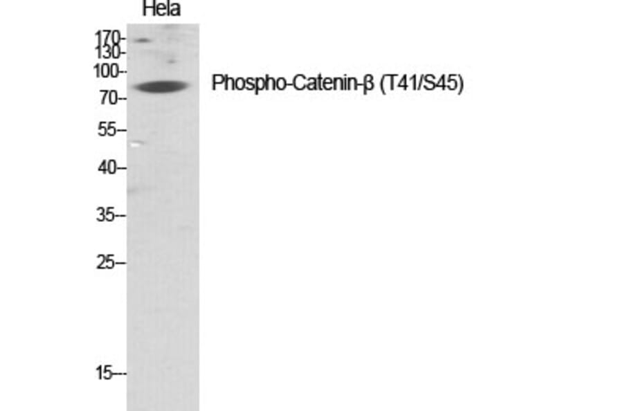 Western Blot - Anti-beta Catenin (phospho Thr41 + Ser45) Antibody (A7024) - Antibodies.com