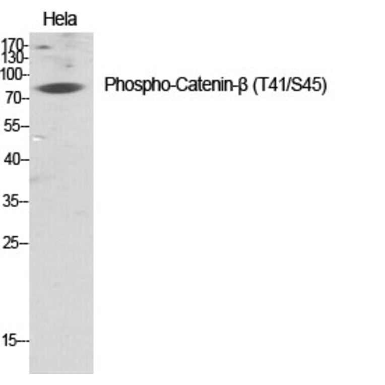 Western Blot - Anti-beta Catenin (phospho Thr41 + Ser45) Antibody (A7024) - Antibodies.com