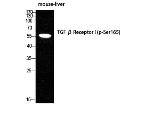 Western Blot - Anti-TGF beta Receptor I (phospho Ser165) Antibody (A1126) - Antibodies.com