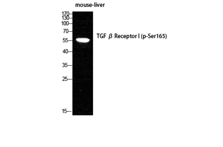 Western Blot - Anti-TGF beta Receptor I (phospho Ser165) Antibody (A1126) - Antibodies.com