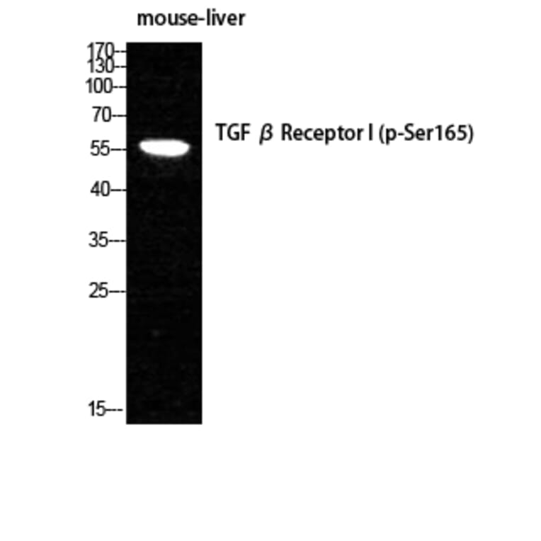 Western Blot - Anti-TGF beta Receptor I (phospho Ser165) Antibody (A1126) - Antibodies.com