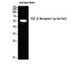 Western Blot - Anti-TGF beta Receptor I (phospho Ser165) Antibody (A1126) - Antibodies.com