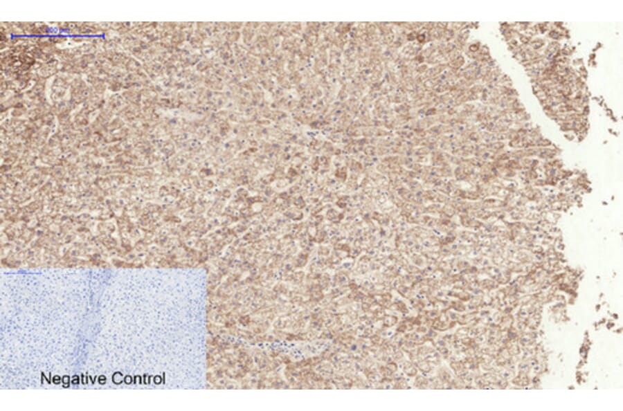 Immunohistochemistry - Anti-TGF beta Receptor I (phospho Ser165) Antibody (A1126) - Antibodies.com