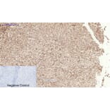 Immunohistochemistry - Anti-TGF beta Receptor I (phospho Ser165) Antibody (A1126) - Antibodies.com