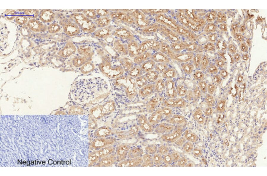 Immunohistochemistry - Anti-TGF beta Receptor I (phospho Ser165) Antibody (A1126) - Antibodies.com