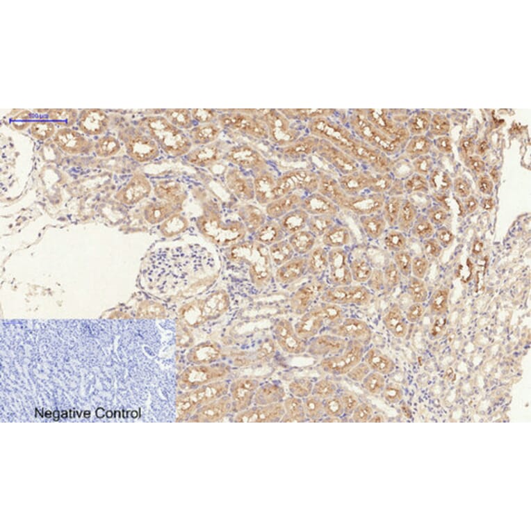 Immunohistochemistry - Anti-TGF beta Receptor I (phospho Ser165) Antibody (A1126) - Antibodies.com