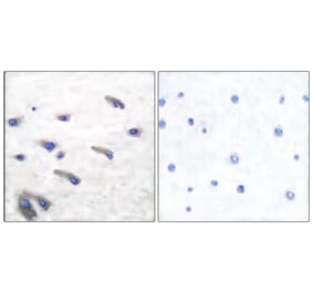 Immunohistochemistry - Anti-PDGF Receptor beta (phospho Tyr751) Antibody (A7194) - Antibodies.com