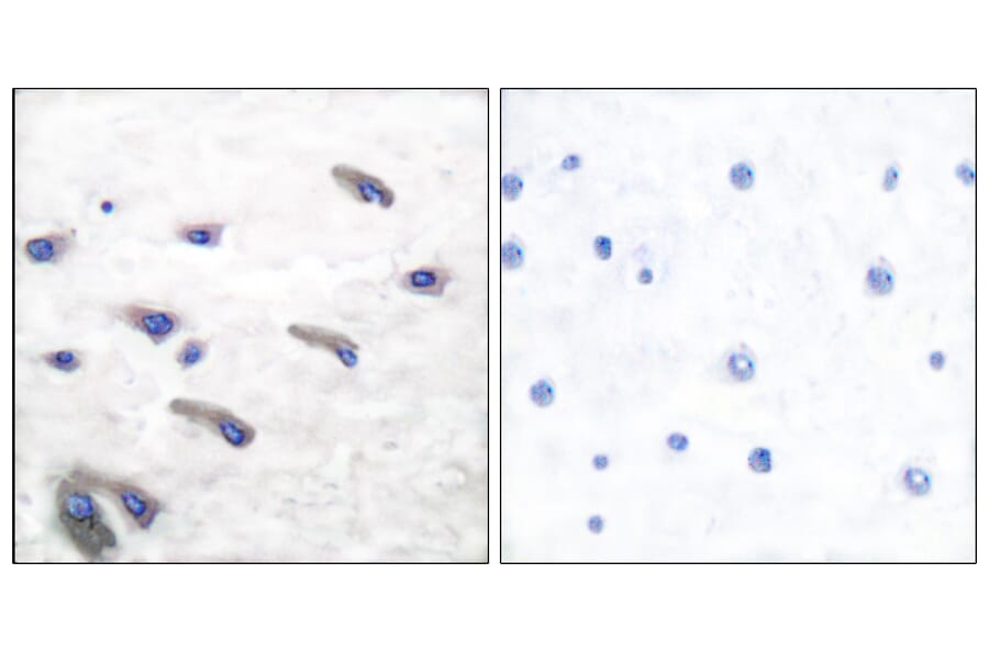 Immunohistochemistry - Anti-PDGF Receptor beta (phospho Tyr751) Antibody (A7194) - Antibodies.com