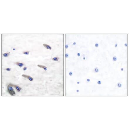 Immunohistochemistry - Anti-PDGF Receptor beta (phospho Tyr751) Antibody (A7194) - Antibodies.com